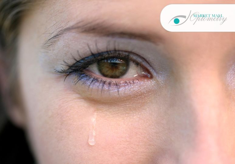 Not Just Tears: Surprising Signs and Symptoms of Dry Eye You Shouldn't Ignore